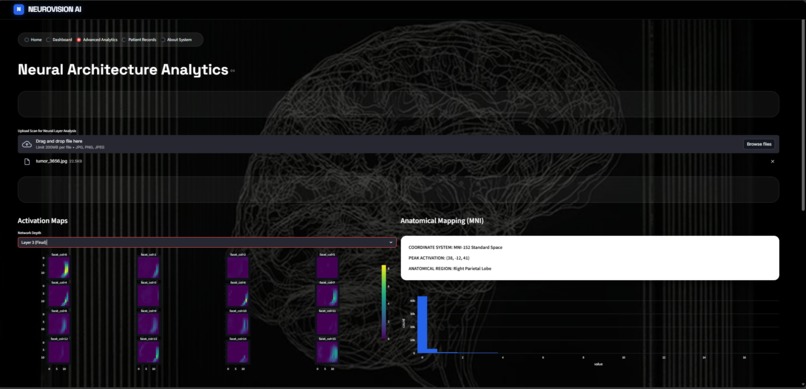 NeuroVision AI – screenshot 5