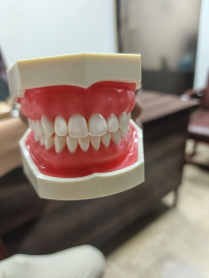 Reconstruction of Tooth – screenshot 1