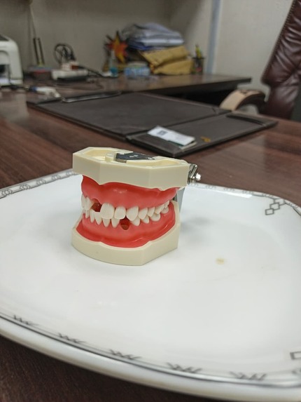 Reconstruction of Tooth – screenshot 2