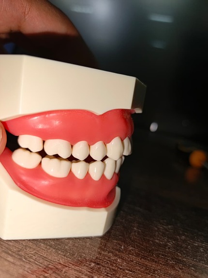 Reconstruction of Tooth – screenshot 4