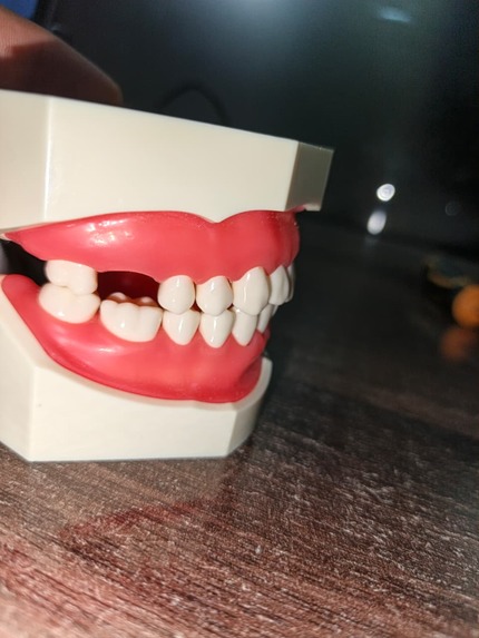 Reconstruction of Tooth – screenshot 5