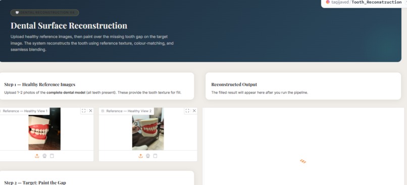 Reconstruction of Tooth – screenshot 6
