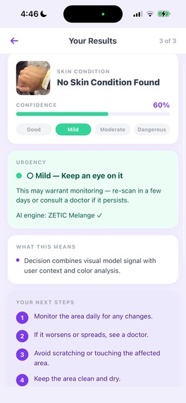 SkinPin – screenshot 3
