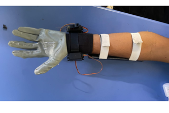 Dextra:Smart Wrist-Hand Orthosis for Functional Independence