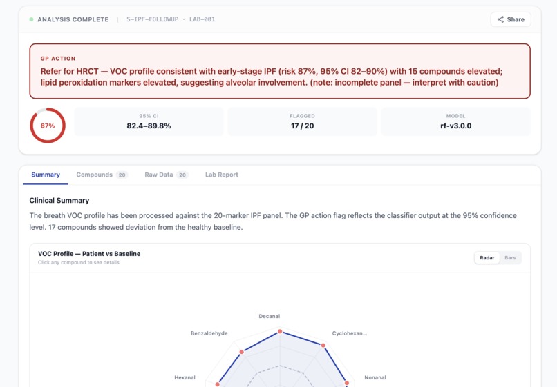 PulmoBreathAI – screenshot 6