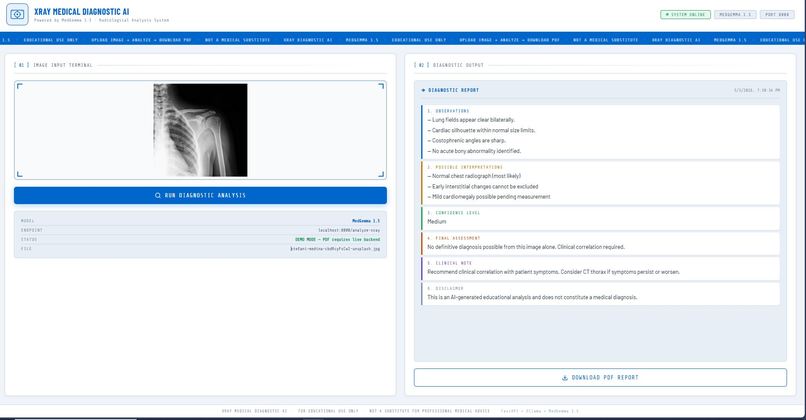  RadAI — AI X-ray Diagnostic System – screenshot 1