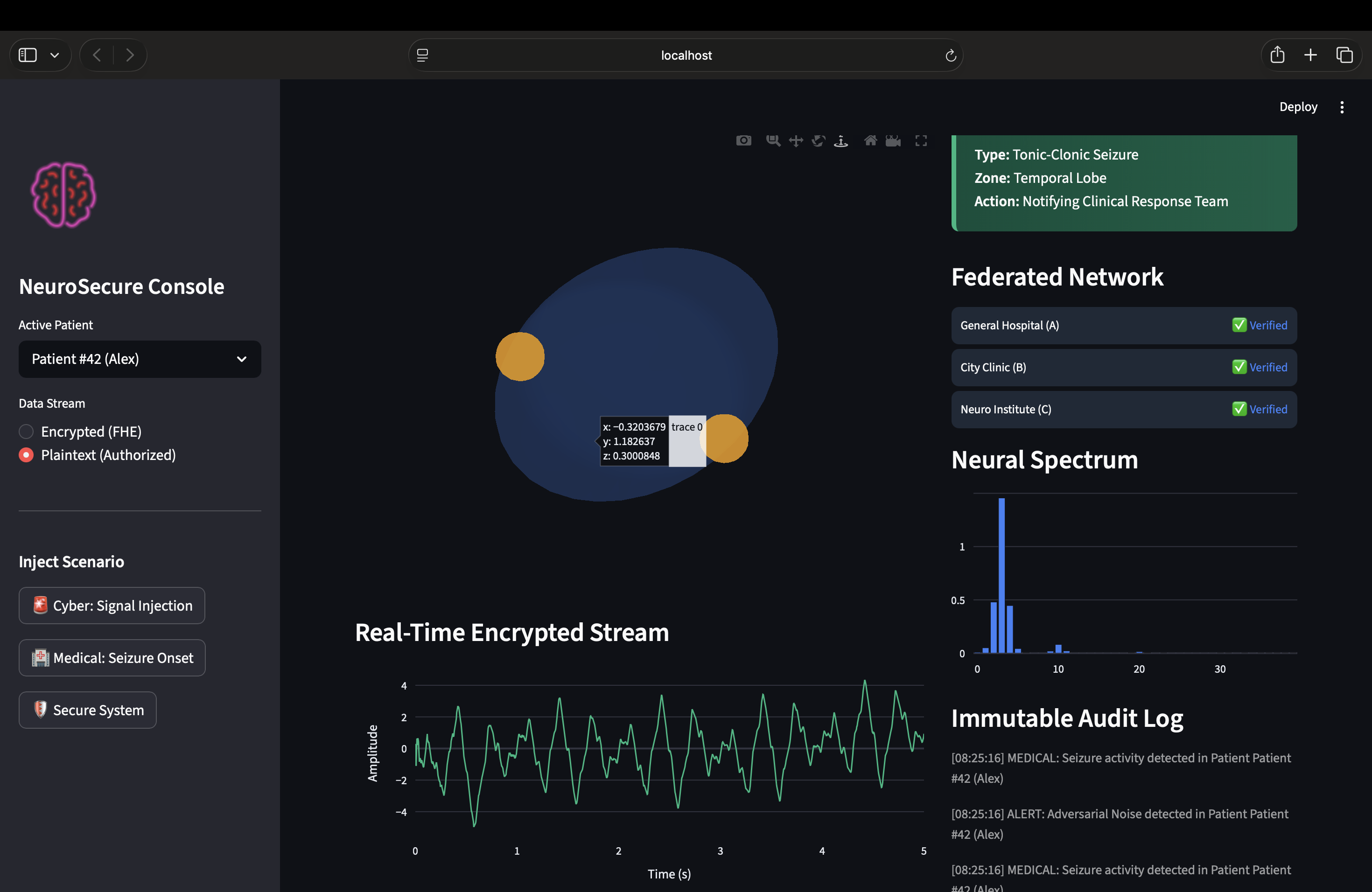 Brain computer interference | Devpost