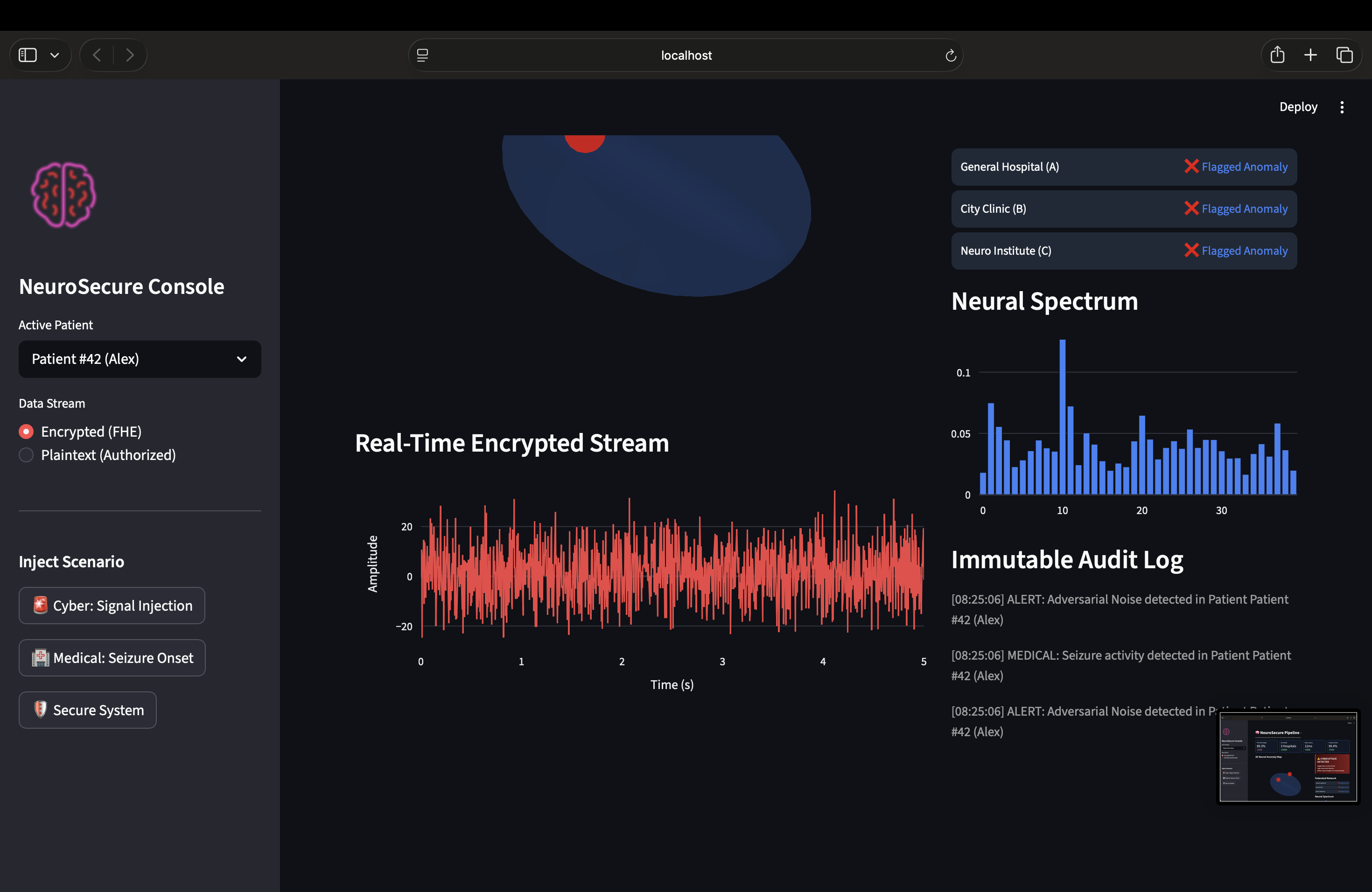 Brain computer interference | Devpost