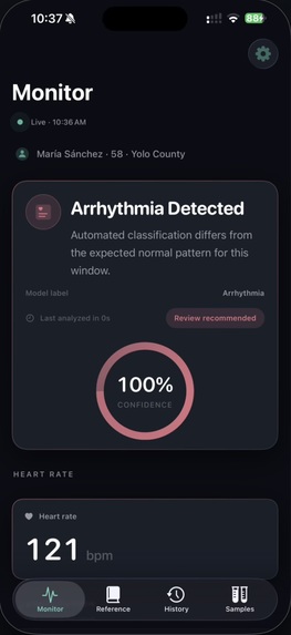 CardioSense – screenshot 1