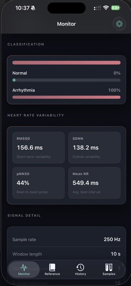 CardioSense – screenshot 2