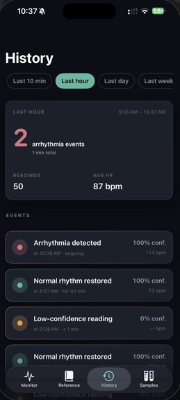 CardioSense – screenshot 3