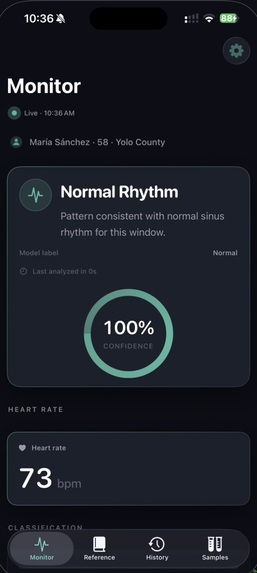 CardioSense – screenshot 4