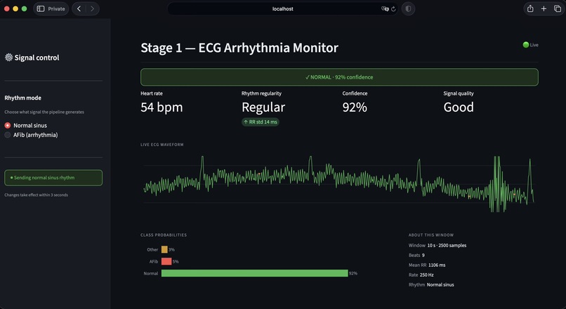 CardioSense – screenshot 5