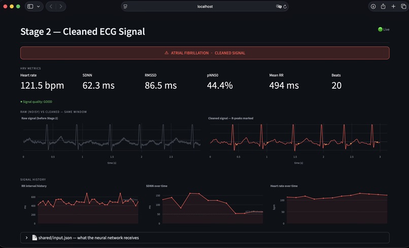 CardioSense – screenshot 6