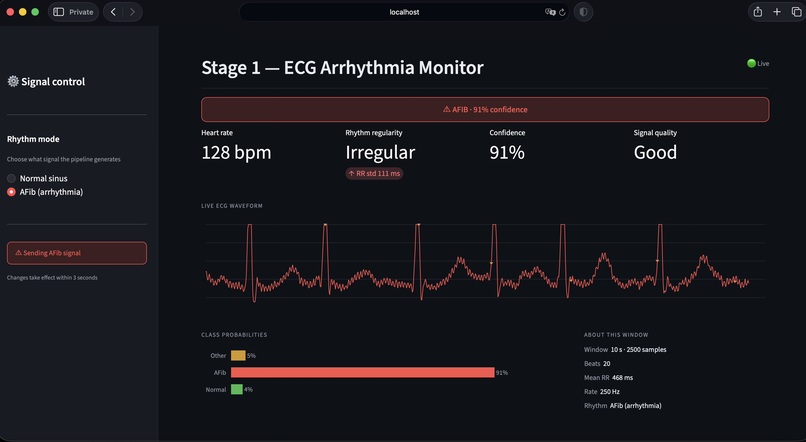 CardioSense – screenshot 7