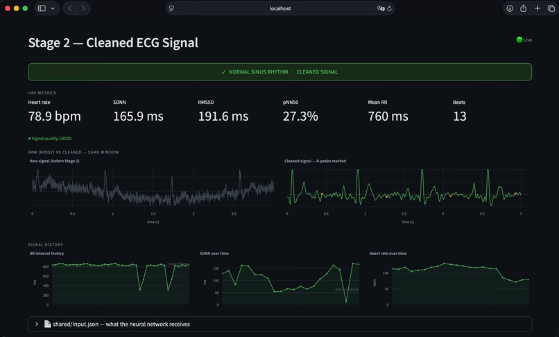 CardioSense – screenshot 8