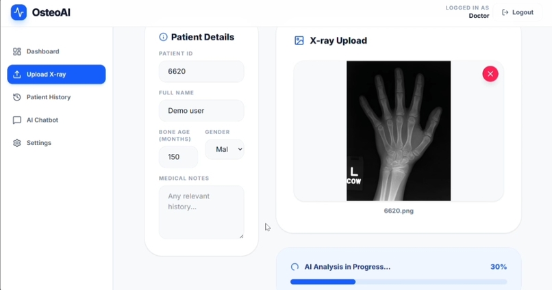 OsteoAI: AI-Based Osteoporosis Risk Detection – screenshot 5