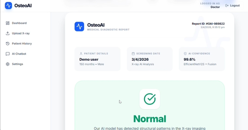 OsteoAI: AI-Based Osteoporosis Risk Detection – screenshot 6