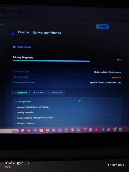 Skin Disease Detection by AI – screenshot 1