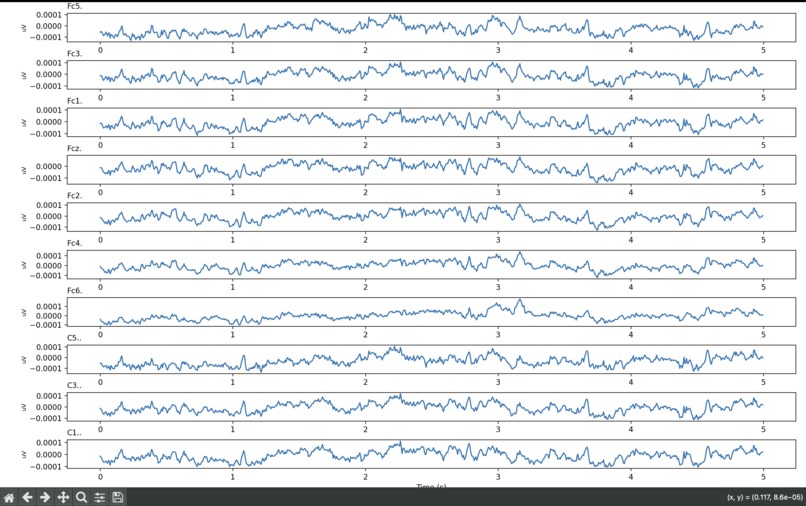 EEG Scan Visualization – screenshot 3