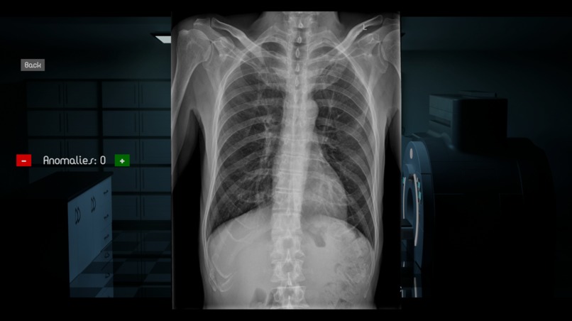 Case X – screenshot 6