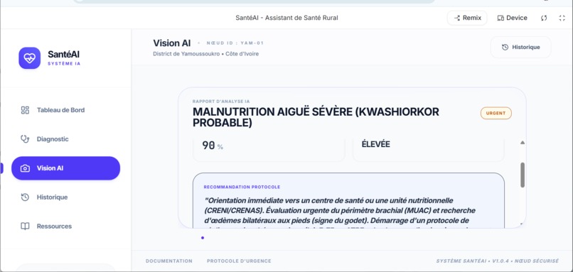 sante-ai – screenshot 1