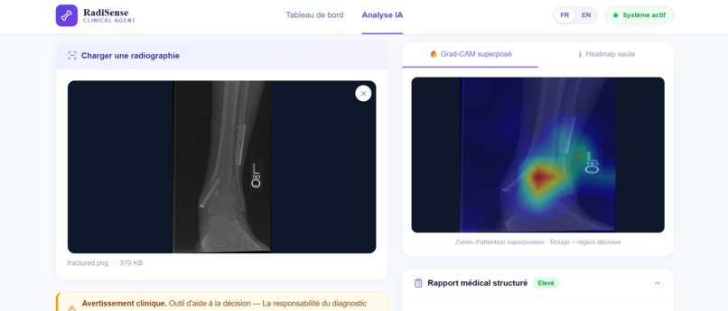 RadiSense – screenshot 3