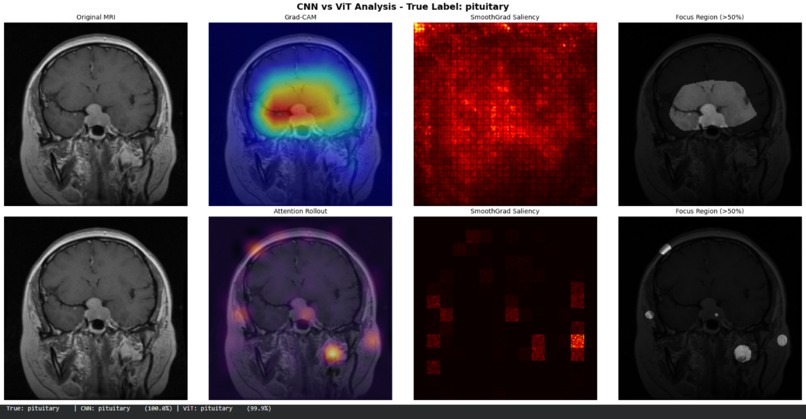NeuroLens – screenshot 3