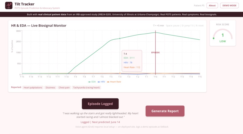 Tilt Tracker – screenshot 1