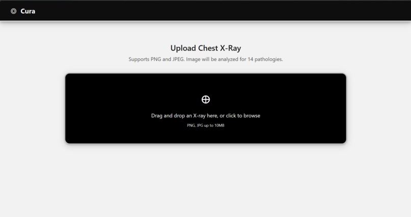 Cura: An AI-Powered Application for Chest X-Ray Analysis – screenshot 1