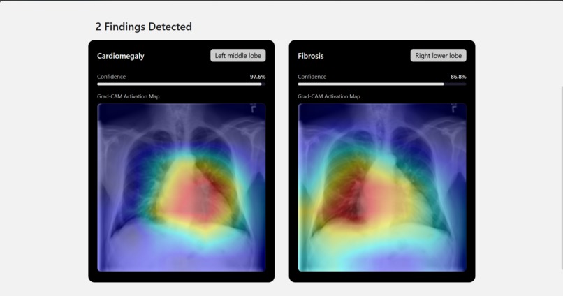 Cura: An AI-Powered Application for Chest X-Ray Analysis – screenshot 4