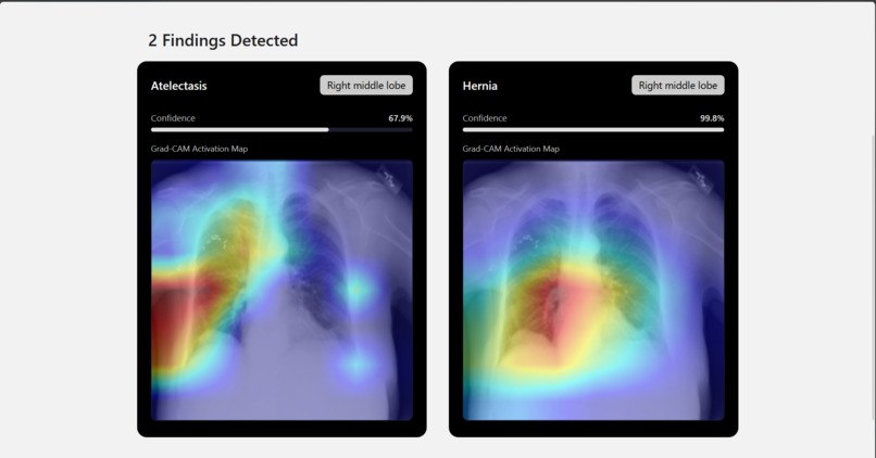 Cura: An AI-Powered Application for Chest X-Ray Analysis – screenshot 5