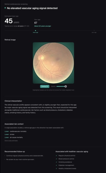 HeartSight – screenshot 2