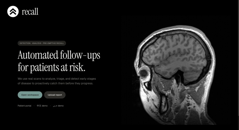Recall – screenshot 1