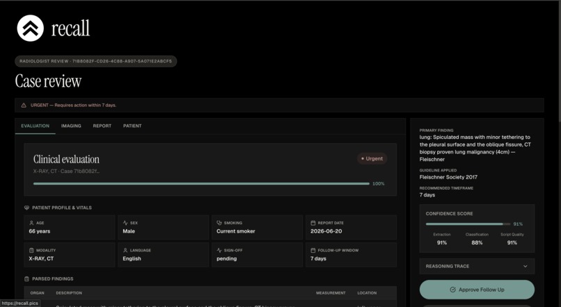 Recall – screenshot 2