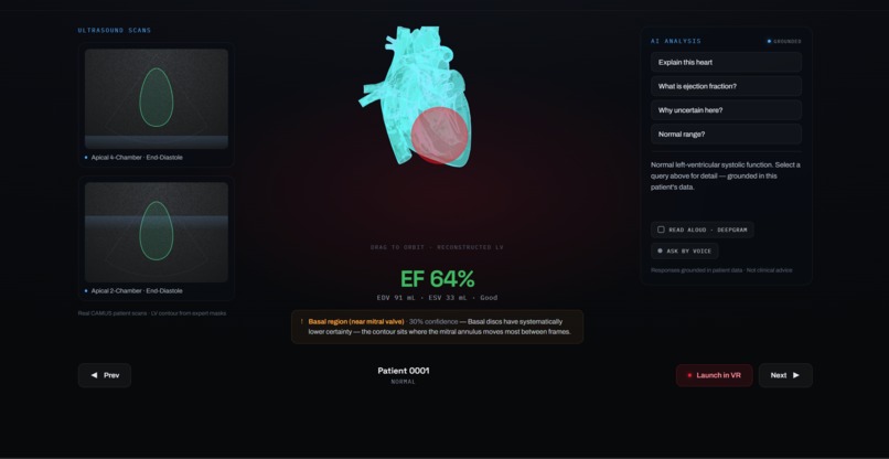 SonoXR – screenshot 4