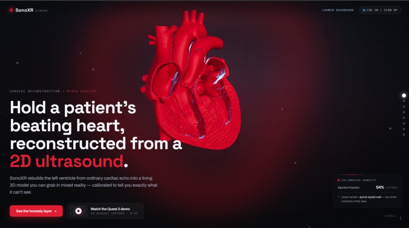 SonoXR – screenshot 1