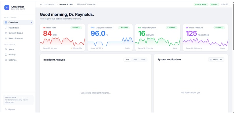 ICU AI Monitor – screenshot 1
