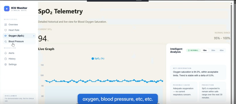 ICU AI Monitor – screenshot 3