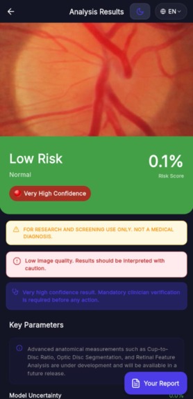 IRIS-AI POWERED EYE SCREENING PARTNER – screenshot 10