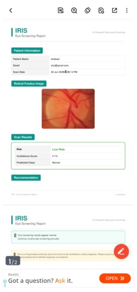 IRIS-AI POWERED EYE SCREENING PARTNER – screenshot 12