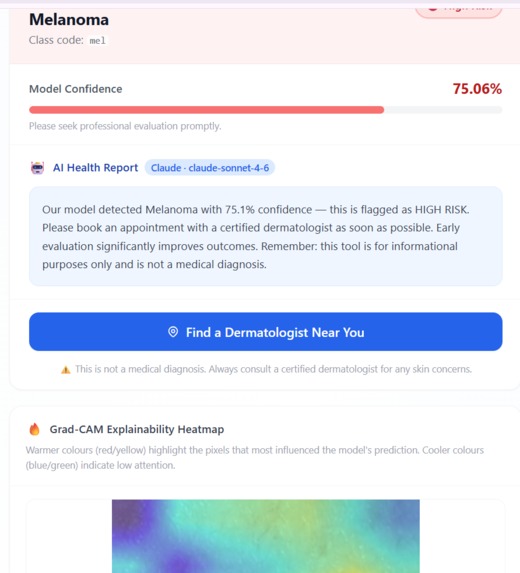 SkinScan AI – screenshot 8