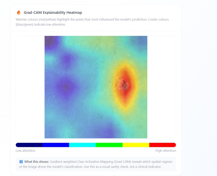 SkinScan AI – screenshot 4