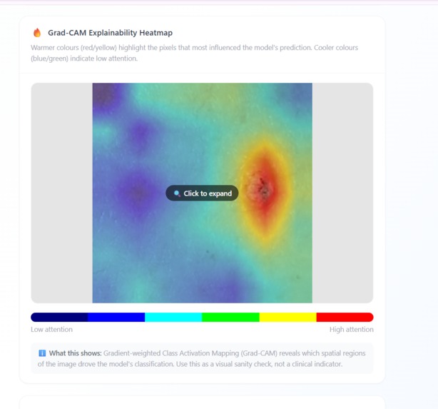 SkinScan AI – screenshot 9