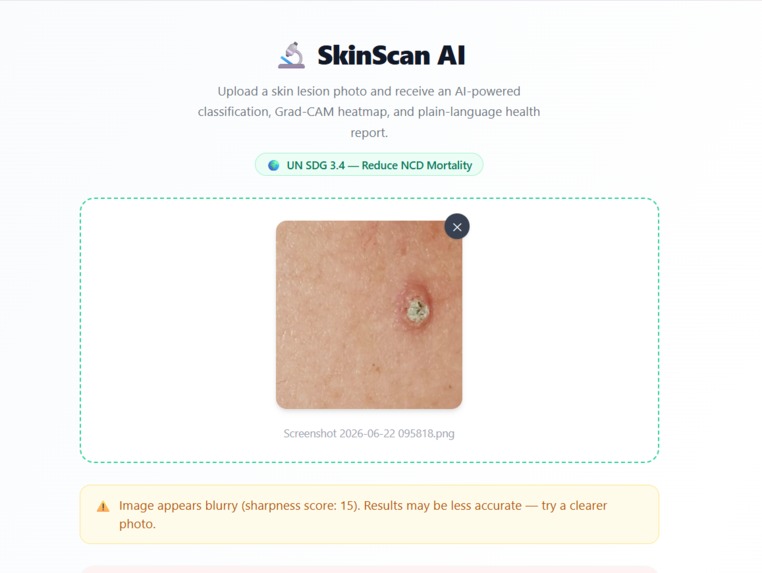SkinScan AI – screenshot 1