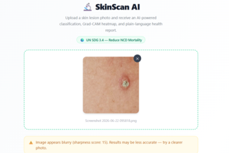 SkinScan AI