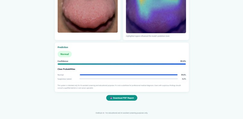 Oral Scan AI – screenshot 2