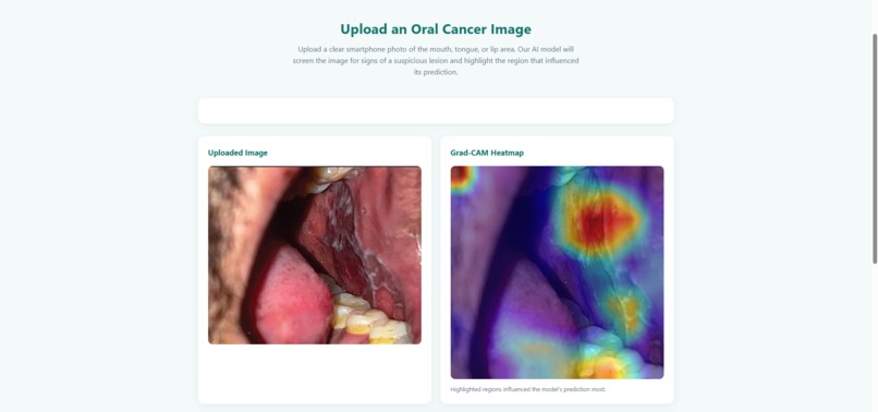 Oral Scan AI – screenshot 3