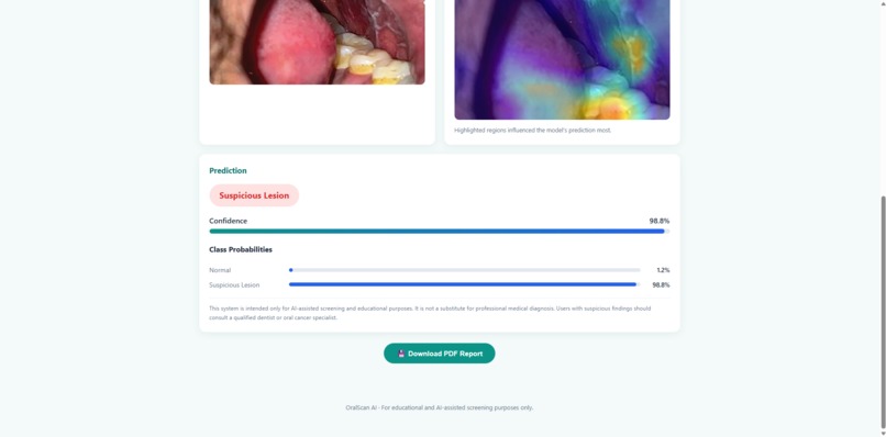Oral Scan AI – screenshot 4