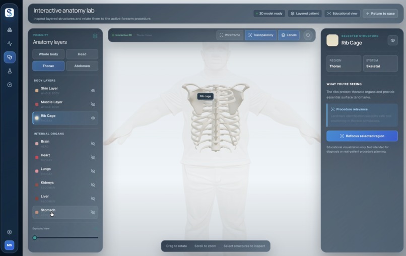 Surgify AI – screenshot 2
